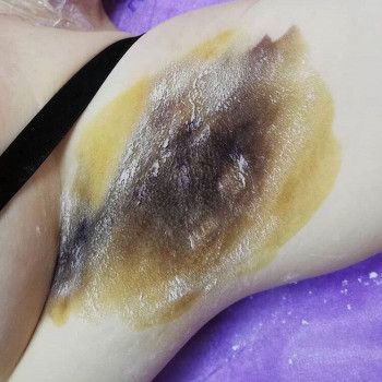 Ботулинотерапия
                    Косметологический центр Надия Кривой Рог