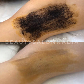 Ботулинотерапия
                    Косметологический центр Надия Кривой Рог