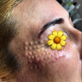 Мезотерапия
                    Косметологический центр Надия Кривой Рог