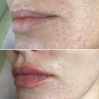 Ірина Білоусова, Черкаси Фото - 41