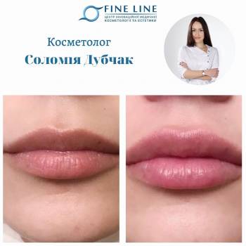 Fine Line, Ивано-Франковск Фото - 13