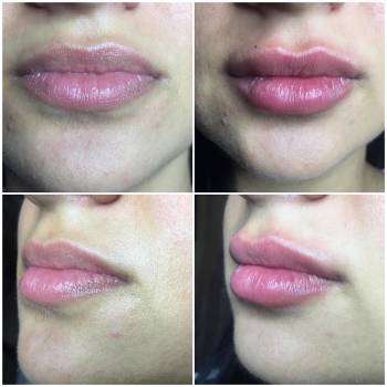 Fine Line, Ивано-Франковск Фото - 9