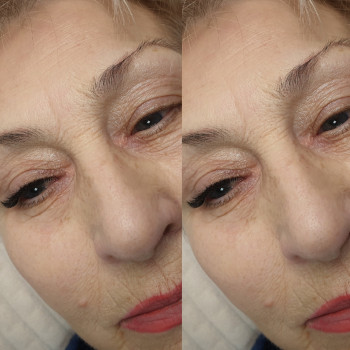 Нарощення вій
                    Салон краси MM Studio Тернопіль