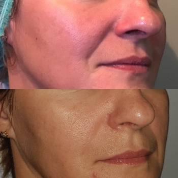 Фото с портфолио Эвелина Тарасова