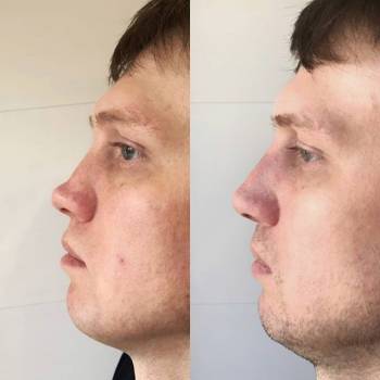 Игорь Сумароков , Херсон Фото - 5