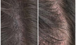 Камуфляж залысин Майстер перманентного макіяжу Елена Ростовщикова Дніпро