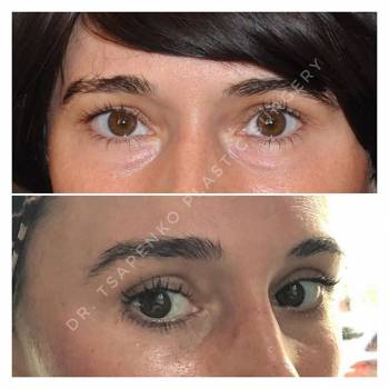 Алексей Цапенко, Черкассы Фото - 5