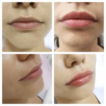 FILLERBAR, Киев Фото - 12