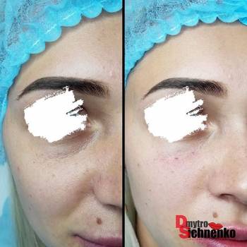 Дмитрий Сичненко , Сумы Фото - 7