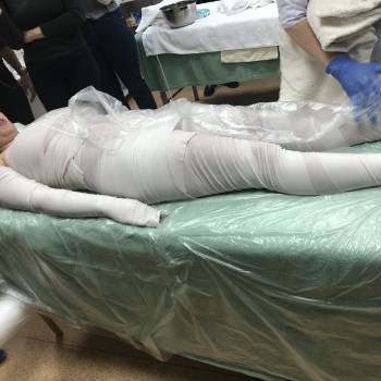 Виски пеленания 