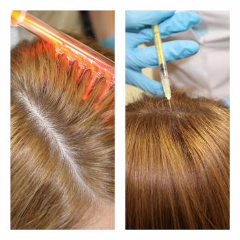 Юлия Слюсаренко, Харків Фото - 9