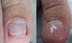 Протезирование ногтевой пластины гелем BAEHR Нігтьова студія La Rouge Харків