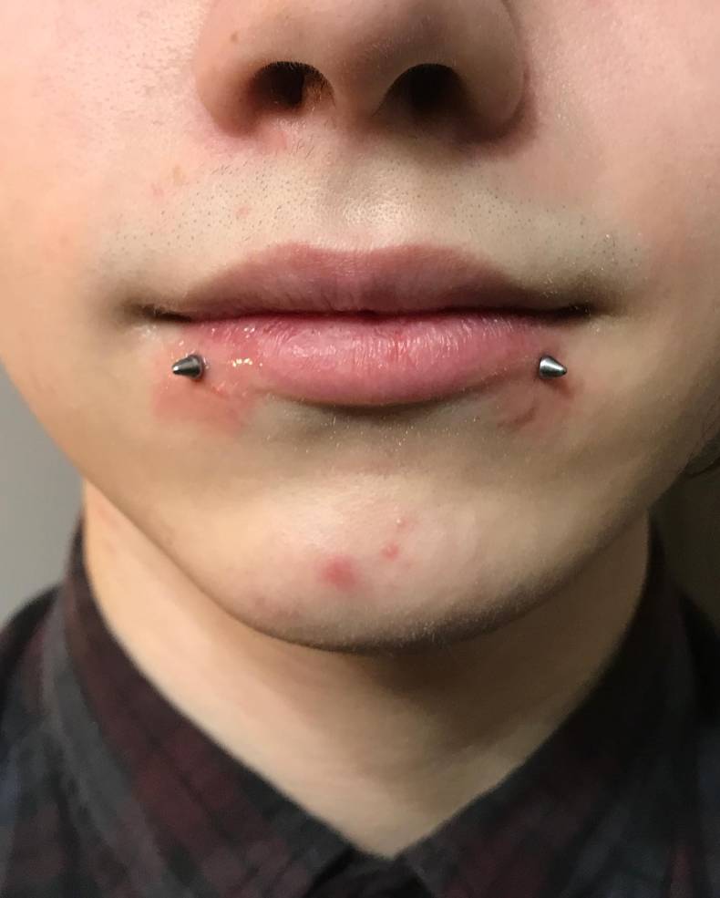Пирсинг губ, фото - Студия татуажа Elf Tattoo