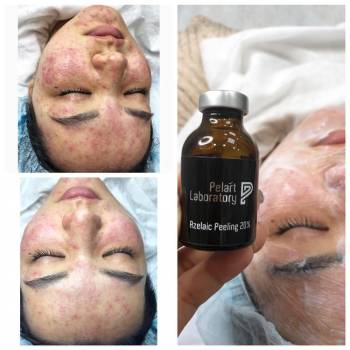 Фото с портфолио Pelart Laboratory