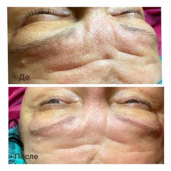 Альбина Михова , Одесса Фото - 14