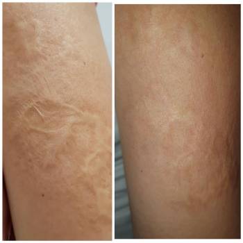 Альбина Михова , Одесса Фото - 16