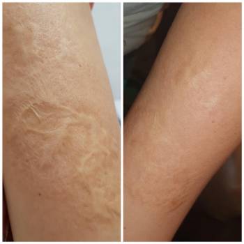 Альбина Михова , Одесса Фото - 17