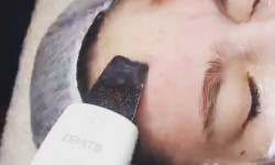 Комбинированная чистка лица Косметолог Любовь Львів