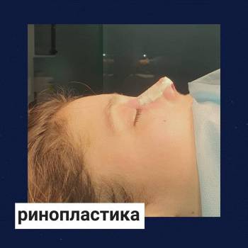 Клініка Стахіва “До і Після”, Тернополь Фото - 6