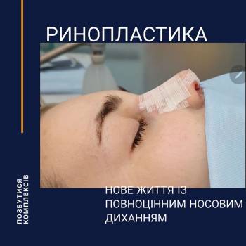 Клініка Стахіва “До і Після”, Тернополь Фото - 3