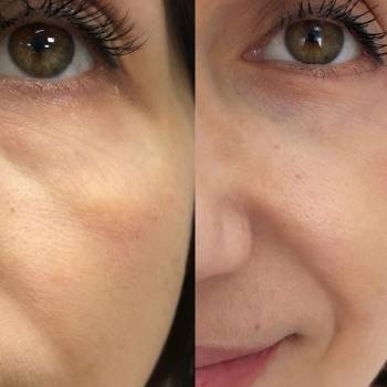 Сергій Козарь , Ужгород Фото - 5