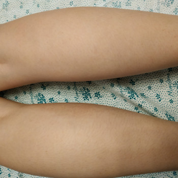 Шугаринг
                    Мастер депиляции Наталья Харьков