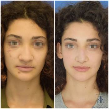 Тамерлан Кадиев , Киев Фото - 6