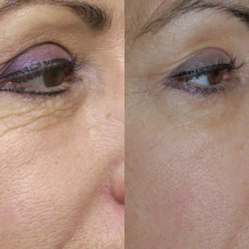 Фото с портфолио Елена 