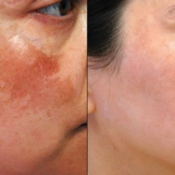 Фото с портфолио Елена 