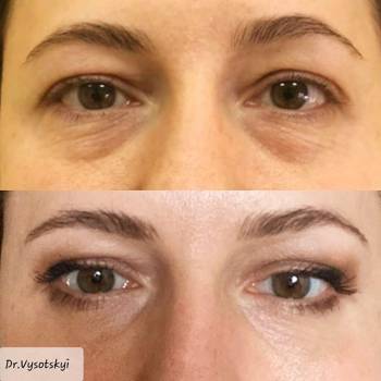 Антон Висоцький , Львов Фото - 6