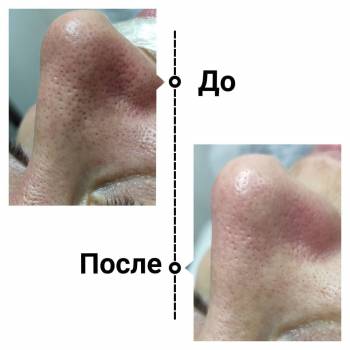 Маргарита Полякова, Киев Фото - 2