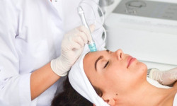 Глибока безболісна вакуумна чистка обличчя Косметолог-ін'єкціоніст Наталя Черкаси