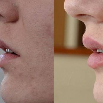 Фото с портфолио Тарас Матолинец 