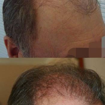 Фото с портфолио Тарас Матолинец 