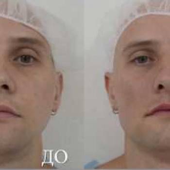 Фото с портфолио Ярослав Огородник 