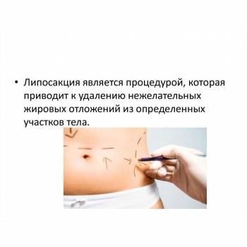 Снежана Бильченко , Київ Фото - 20