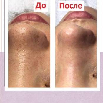 Снежана Бильченко , Київ Фото - 3