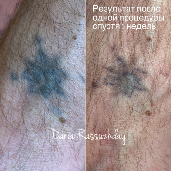 Фото с портфолио Дарья 