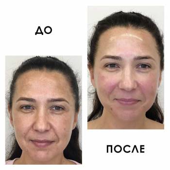 Crocus Aesthetic, Одеса Фото - 28