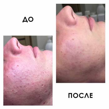 Crocus Aesthetic, Одеса Фото - 29