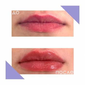 Crocus Aesthetic, Одеса Фото - 31