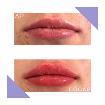 Crocus Aesthetic, Одеса Фото - 32