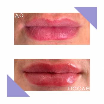 Crocus Aesthetic, Одеса Фото - 33