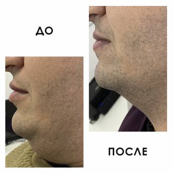 Crocus Aesthetic, Одеса Фото - 34