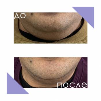 Crocus Aesthetic, Одеса Фото - 35