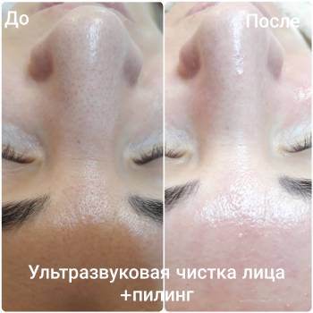 Леся Андрианова , Обухов Фото - 7