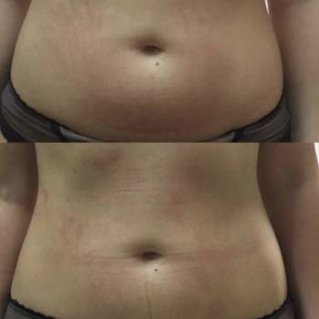 Екатерина Дмитриева, Київ Фото - 5