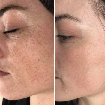 Екатерина Дмитриева, Київ Фото - 8