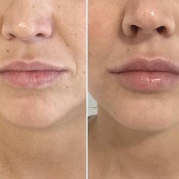 Екатерина Дмитриева, Київ Фото - 11