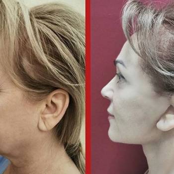 Наталия Численко , Киев Фото - 6